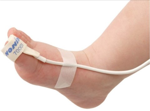 NONIN 7000 FLEXI FORM III Sensor pulsoksymetru dla dorosłych, jednorazowy