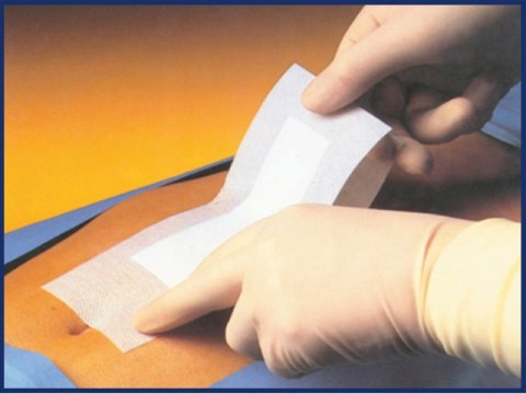 PHARMAPLAST PHARMAPORE 10 × 15 cm Opatrunek samoprzylepny jałowy włókninowy