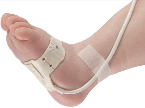 NONIN 7000 FLEXI FORM III Sensor do pulsoksymetru, neonatologiczny, 24 szt.