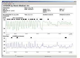 NONIN NVISION Oprogramowanie do zarządzania danymi SpO2, EtCO2, puls, analiza