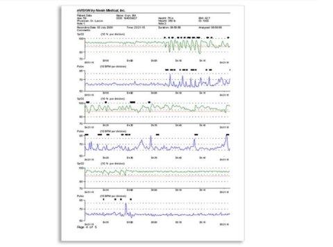 NONIN NVISION Oprogramowanie do zarządzania danymi SpO2, EtCO2, puls, analiza