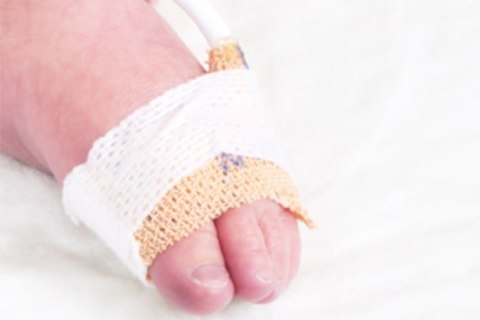 NONIN 6000CP Sensor pulsoksymetru, pediatryczny, technologia PureSAT